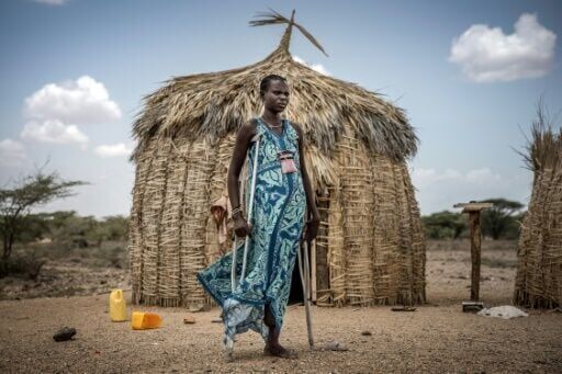 Joyce Lokonyi was victim to mycetoma, which gradually erodes tissue, muscles and bone