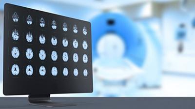 Billy Joel Cancels Tour After Brain Condition Diagnosis